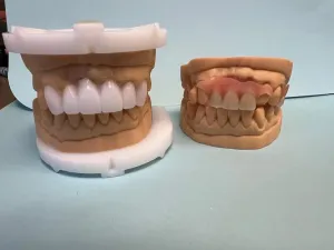 teeth models